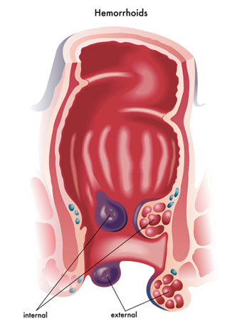 Proctologie - Chirurgie viscérale et digestive Nîmes